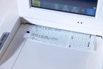 Philips Avalon FM30 KTG z Głowicą US (2) - obrazek 6