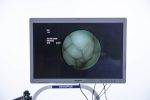 Fujifilm Fujinon FB-120S Giętki Fiberobronchoskop Endoskop - obrazek 10